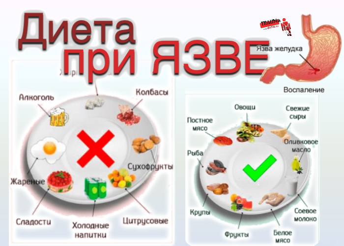 Гастрит Двенадцатиперстной Кишки Диета