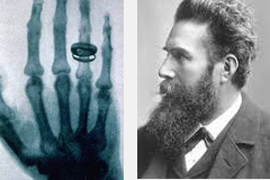 8 ноября 1895 г. физик Вильгельм Рентген открыл «рентгеновские лучи»