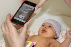 Ученые США создали новый метод диагностики желтухи новорожденных