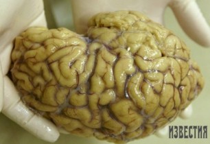 Ամերիկացի գիտնականները խոստանում են մարդկանց վերակենդանացնել` ուղեղները սառեցնելու միջոցով. tert.am