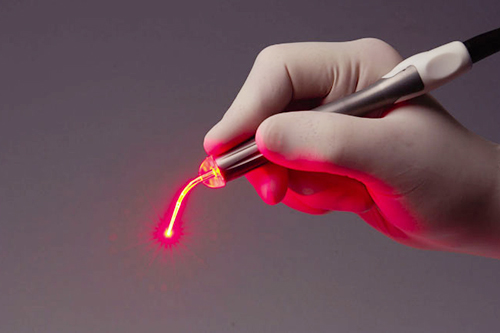 Лазерные технологии - «волшебная палочка» современных гинекологов