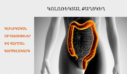 ԿԼԻՆԻԿԱԿԱՆ ՈՒՂԵՑՈՒՅՑՆԵՐ ԵՎ ՎԱՐՄԱՆ ԳՈՐԾԵԼԱԿԱՐԳ. կոլոռեկտալ քաղցկեղ. oncology.am