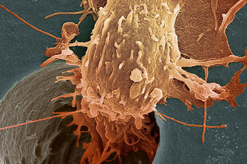 Ученые нашли способ приостанавливать развитие рака последней стадии