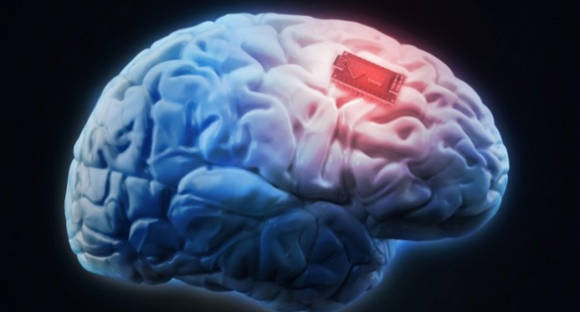 Особый полимер позволит вживлять имплантаты в головной мозг