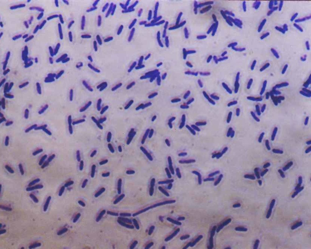 Бактерия синегнойная палочка. Синегнойная палочка микроскопия. Пастереллез микроскопия. Синегнойная палочка по Граму. Pseudomonas aeruginosa по Граму.
