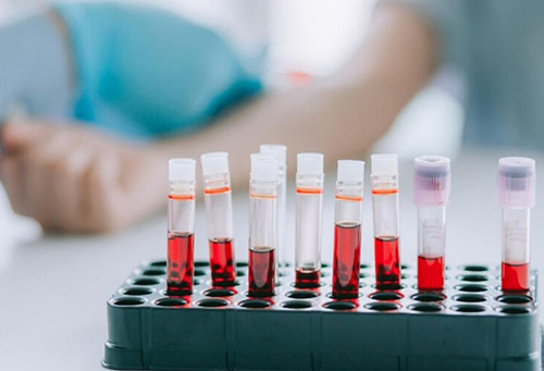 Анализ крови: что ещё нужно сделать перед прививкой от коронавируса?