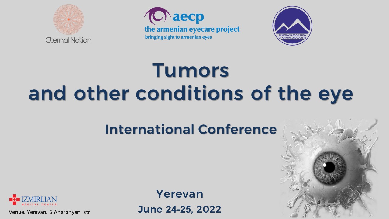 On June 24-25, 2022, «Tumors and other conditions of the eye» international conference On June 24-25, 2022, «Tumors and other conditions of the eye» international conference
