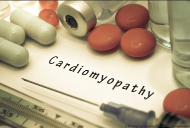 Обновленные рекомендации по лечению пациентов с гипертрофической кардиомиопатией Американской коллегии кардиологов