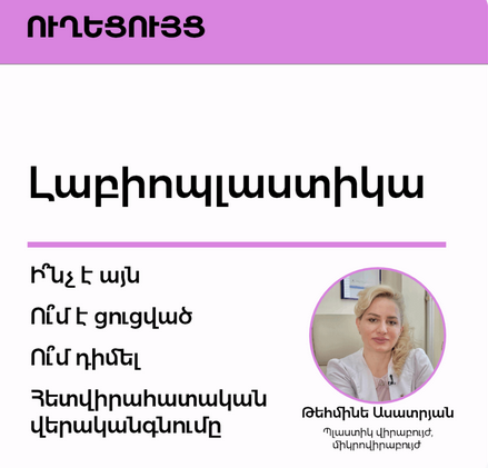 Լաբիոպլաստիկա․ ի՞նչ է դա, ո՞ւմ է անհրաժեշտ և ի՞նչ պետք է իմանալ վիրահատությունից առաջ