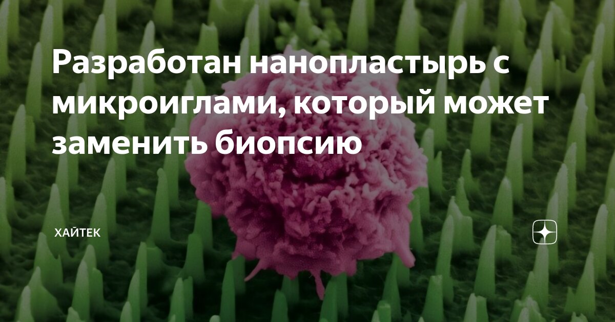 Пластырь с миллионом наноиголок вместо классической биопсии