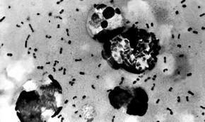 Старые антибиотики смогут работать не хуже новых