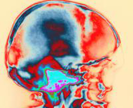 Ученые смогут «обнаружить» сознание пациента после травмы мозга