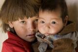 Աղքատ երեխաները երեք անգամ ավելի են տառապում ճարպակալմամբ. 1in.am