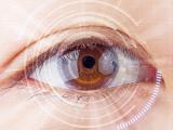 7 мифов о катаракте
