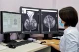Простое измерение МРТ может избежать 30% биопсий для диагностики рака груди