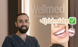 Հոլիվուդյան ժպիտի (վինիրների) դրական և բացասական կողմերը. հարցազրույց Wellmed ստոմատոլոգիական կենտրոնի ստոմատոլոգ-վիրաբույժ Վարդան Ստեփանյանի հետ