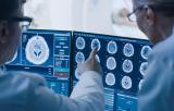 В РФ оценили эффективность искусственного интеллекта при диагностике рака