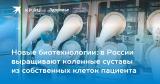 Новые биотехнологии: в России выращивают коленные суставы из собственных клеток пациента В Сеченовском Университете лечат остеоартрит с помощью биомедицинских клеток