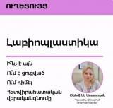 Լաբիոպլաստիկա․ ի՞նչ է դա, ո՞ւմ է անհրաժեշտ և ի՞նչ պետք է իմանալ վիրահատությունից առաջ
