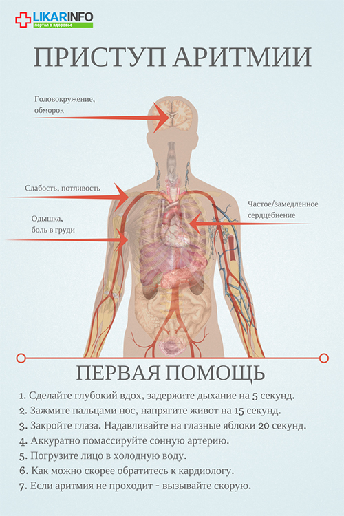 Нарушение сердечного ритма