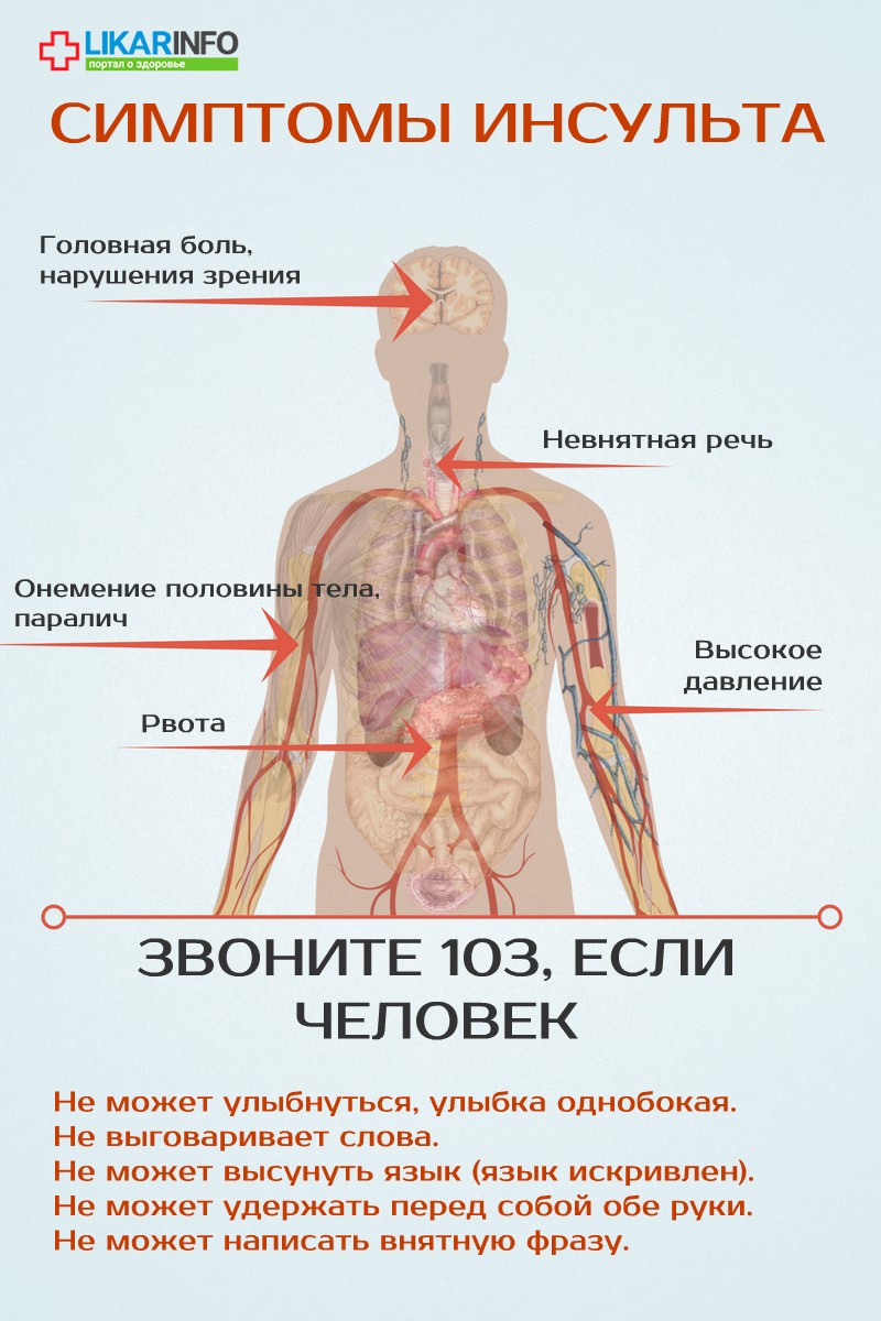 Язык При Инсульте Фото