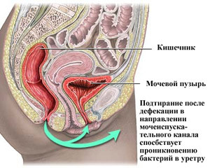 Мочевой Пузырь При Беременности Фото