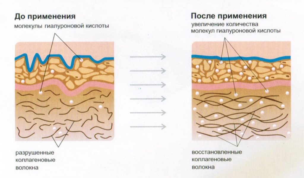  Эффект от коллагена