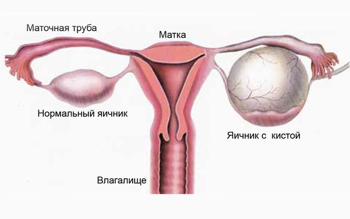 Как Выглядит Яичники Фото